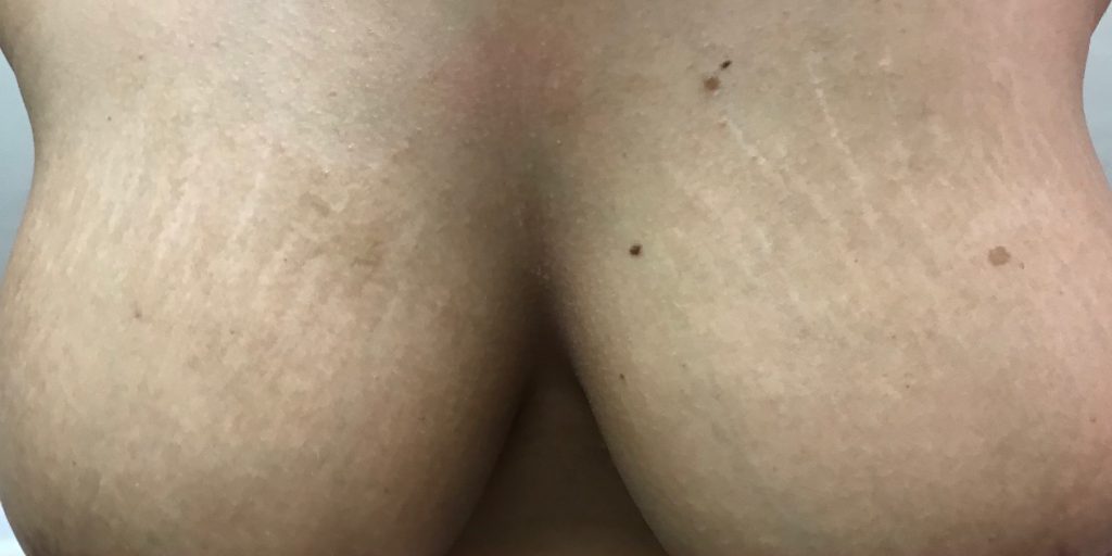 F856193B-A833-4CC6-AF16-2B3C26E90995-1024×1024 F856193B-A833-4CC6-AF16-2B3C26E90995-1024x1024