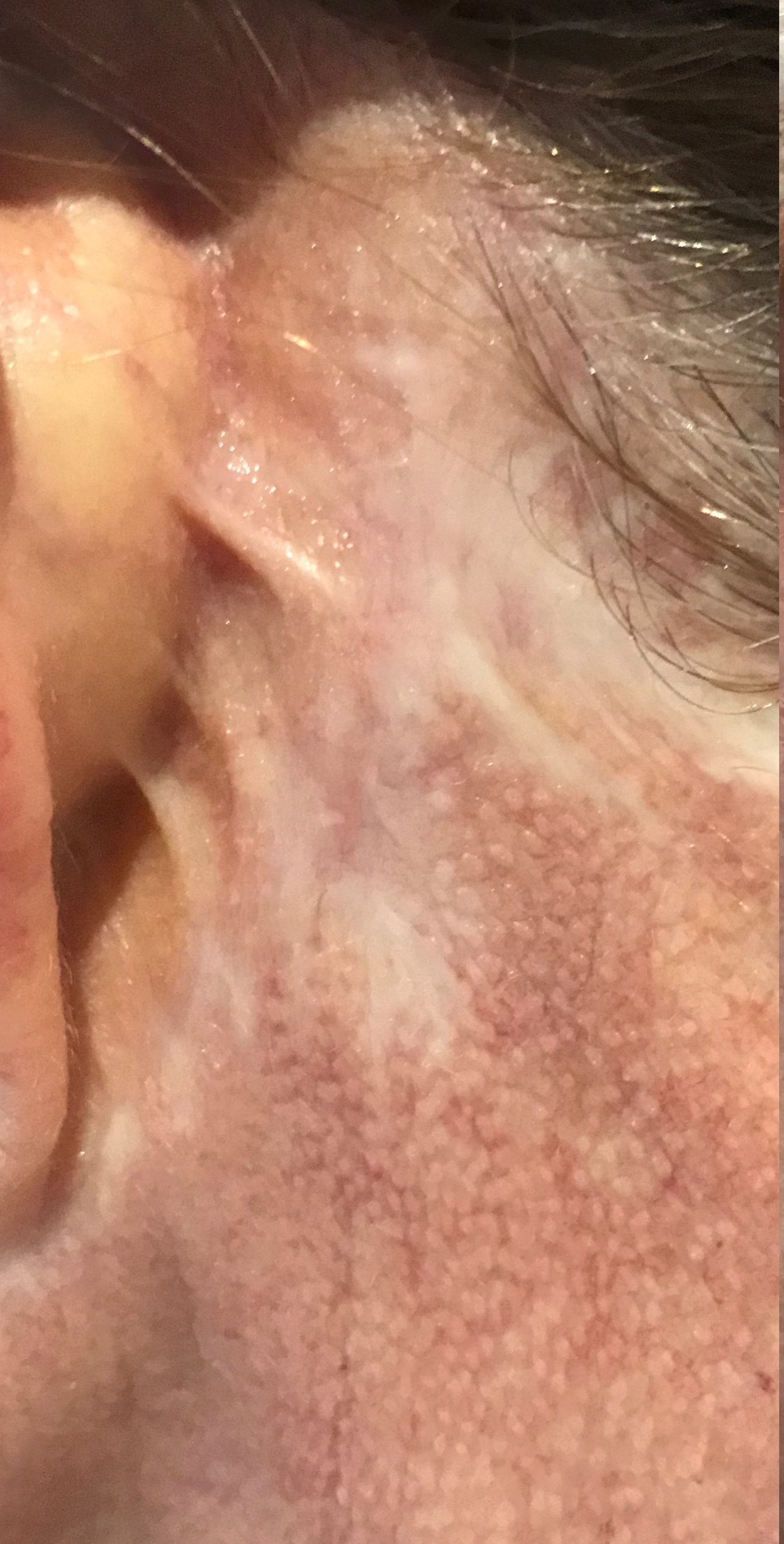 photo-output (1) photo-output (1)